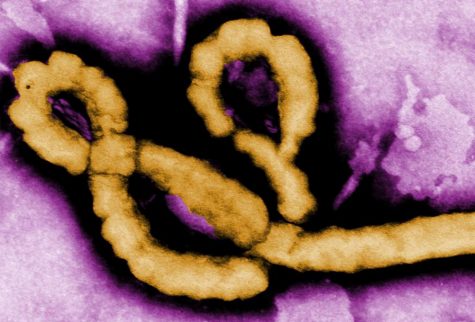 Successful Test to Detect Ebola